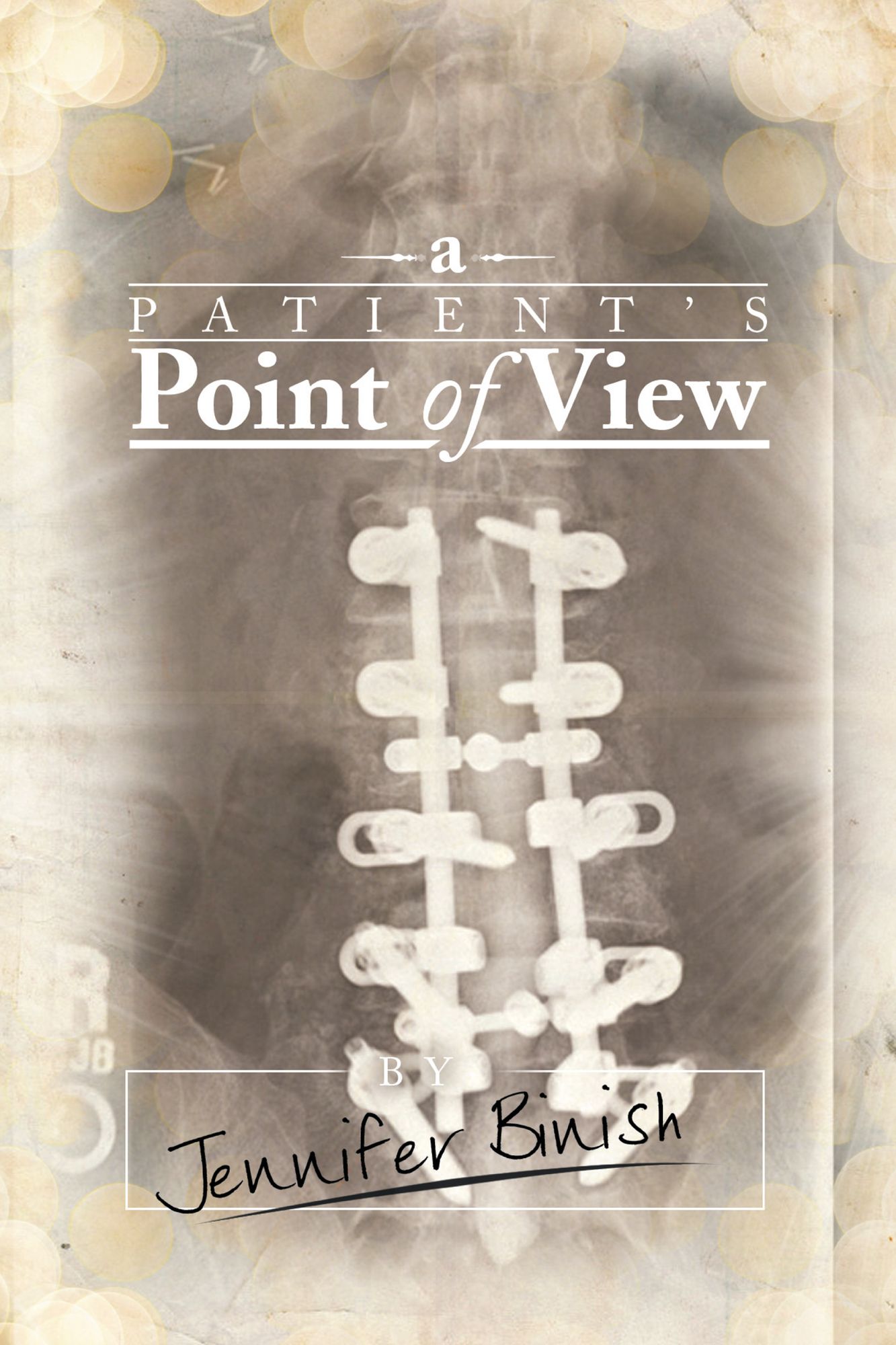 A Patient's Point of View