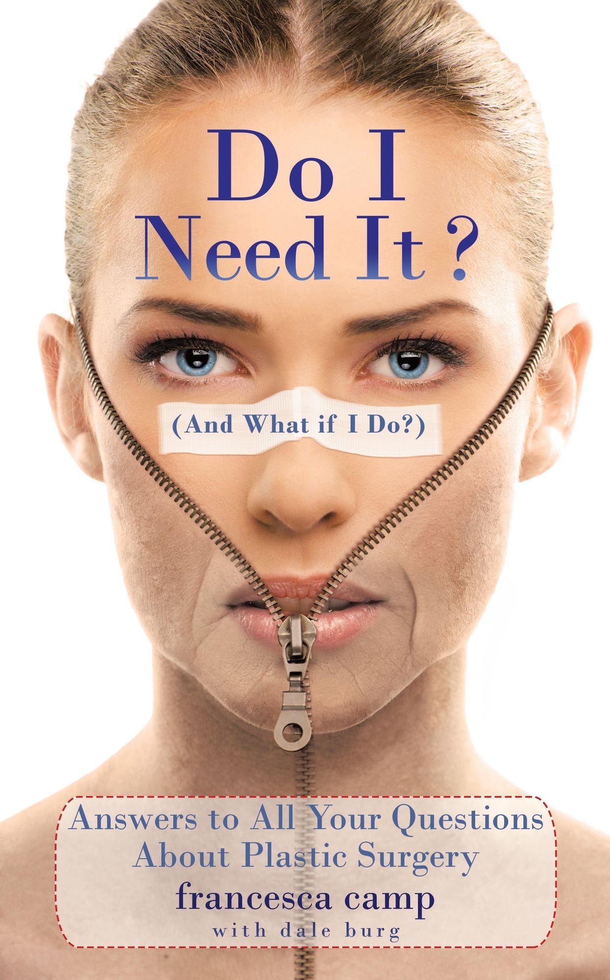 Do I Need It? (And What if I Do?): Answers to All Your Questions about Plastic Surgery