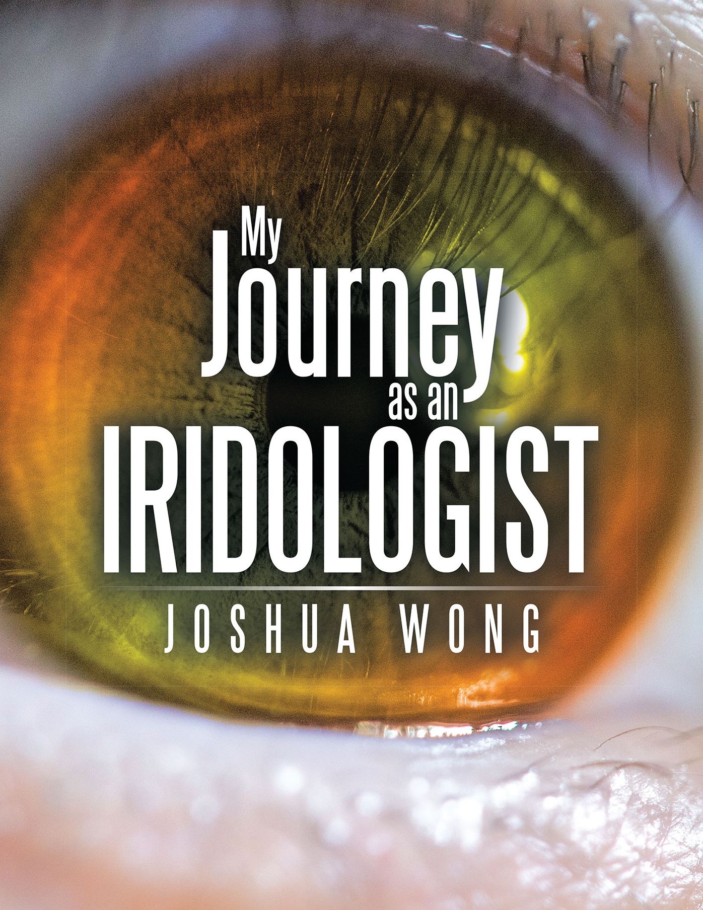 My Journey as an Iridologist