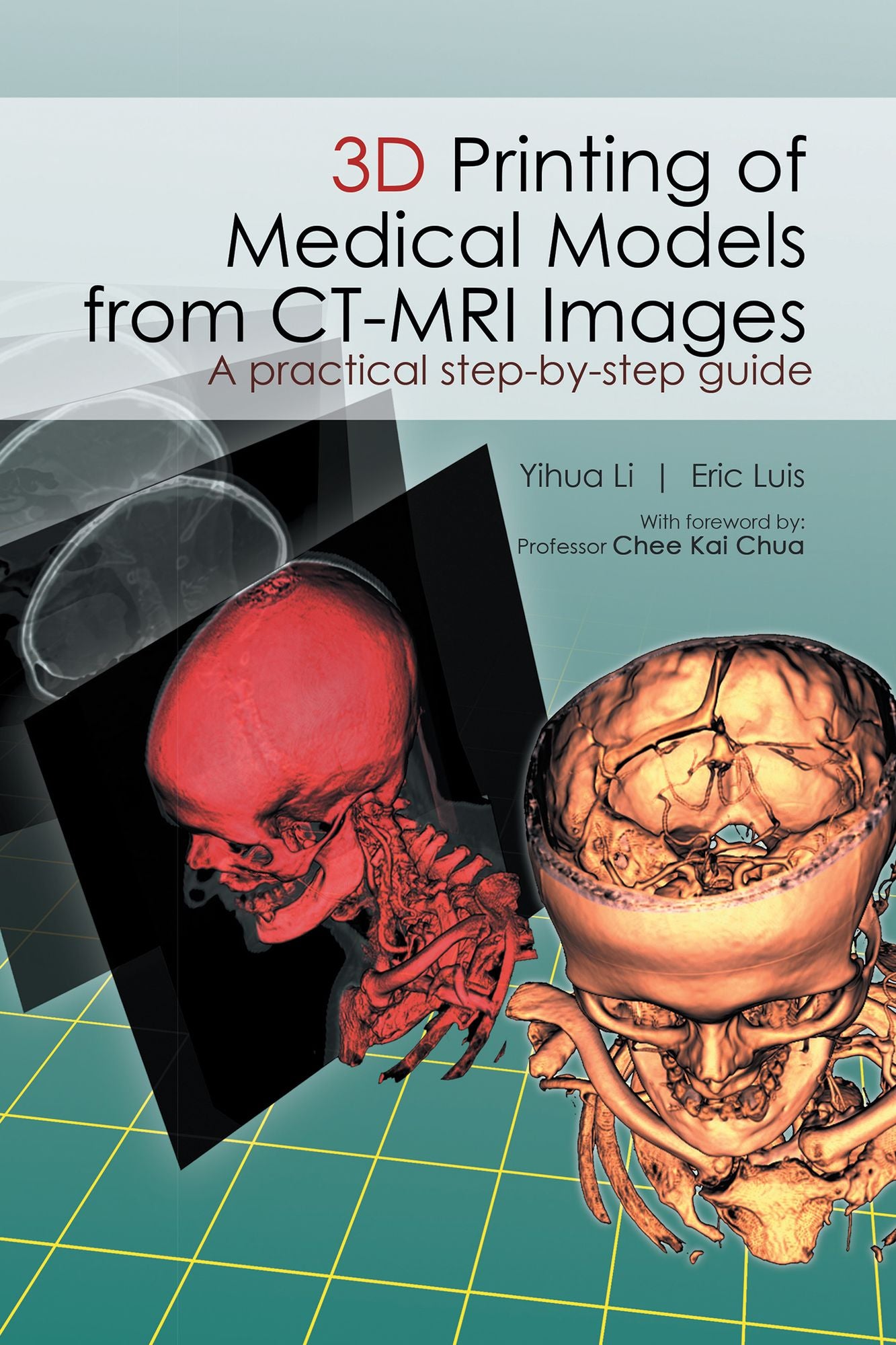 3D Printing of Medical Models from CT-MRI Images: A Practical Step-By-Step Guide