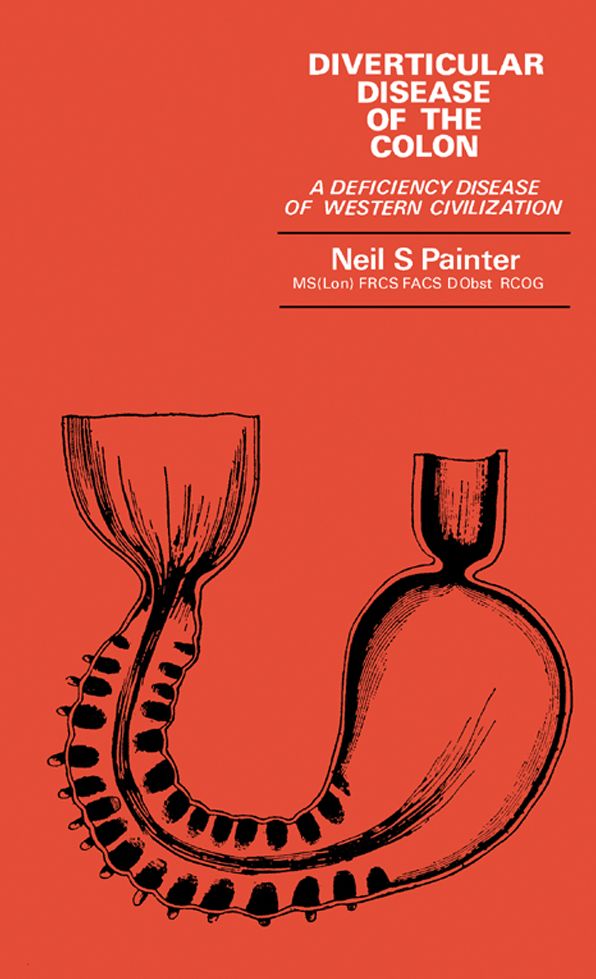 Diverticular Disease of the Colon: A Deficiency Disease of Western Civilization