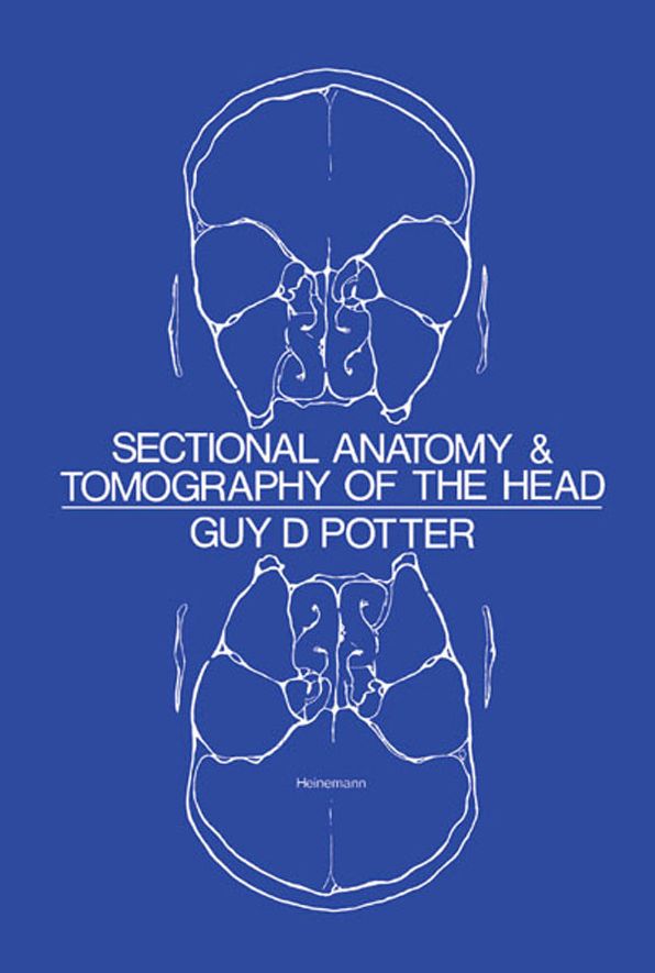 Sectional Anatomy and Tomography of the Head