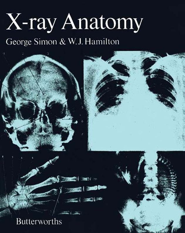 X-Ray Anatomy