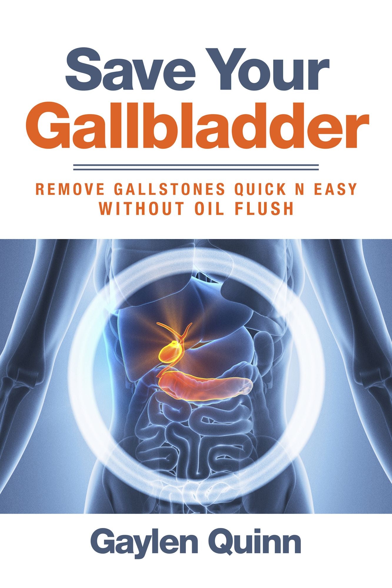 Save Your Gallbladder (Remove Gallstones Quick n Easy Without Oil Flush)