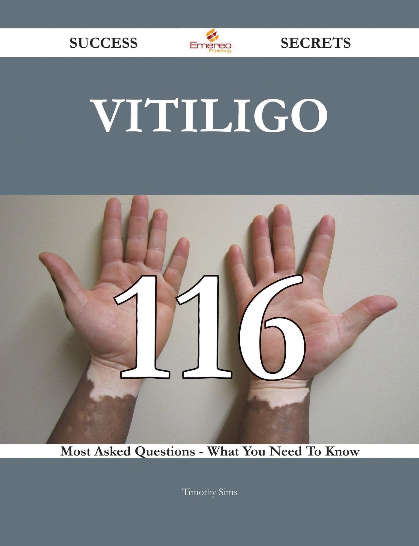 Vitiligo 116 Success Secrets - 116 Most Asked Questions On Vitiligo - What You Need To Know