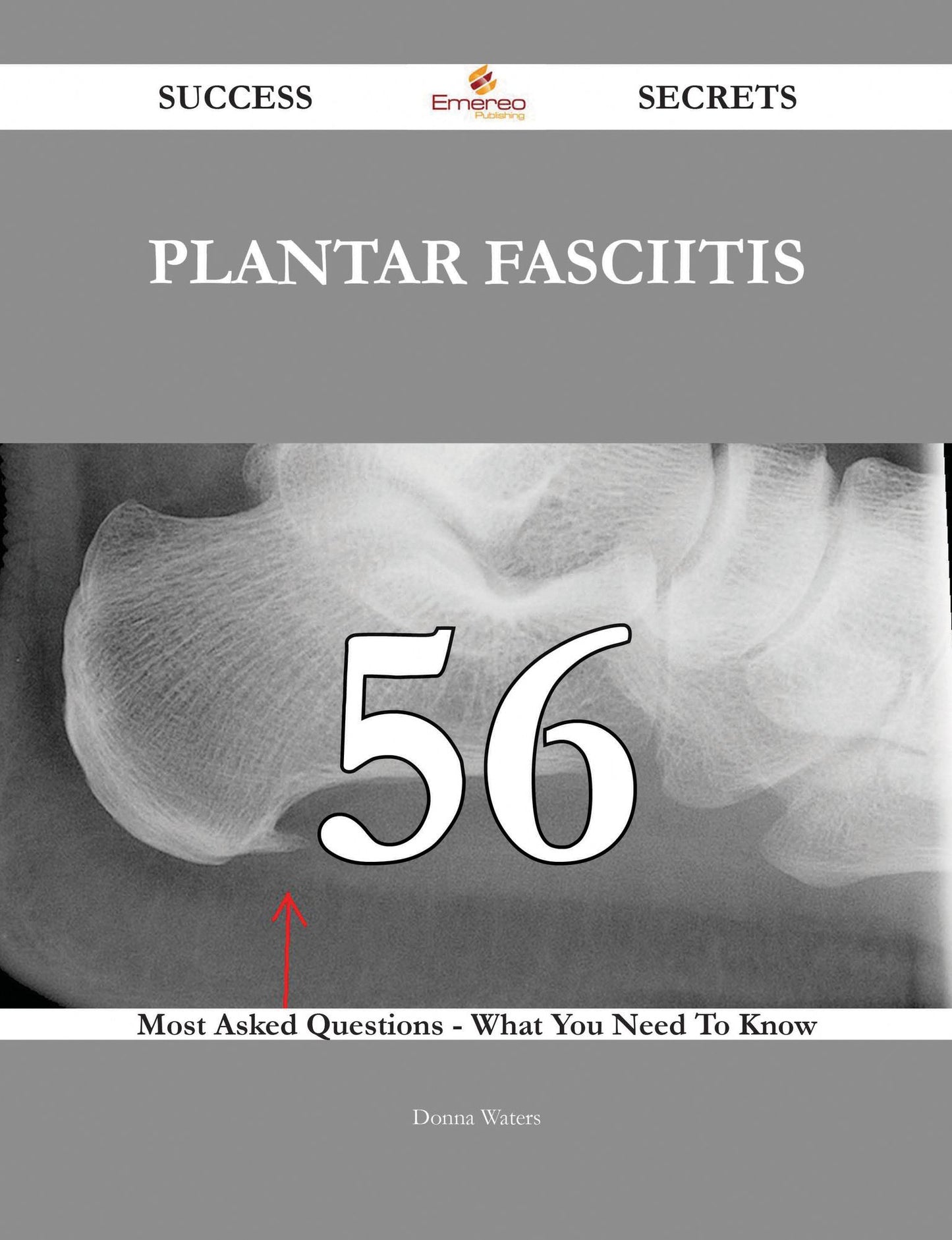 Plantar fasciitis 56 Success Secrets - 56 Most Asked Questions On Plantar fasciitis - What You Need To Know