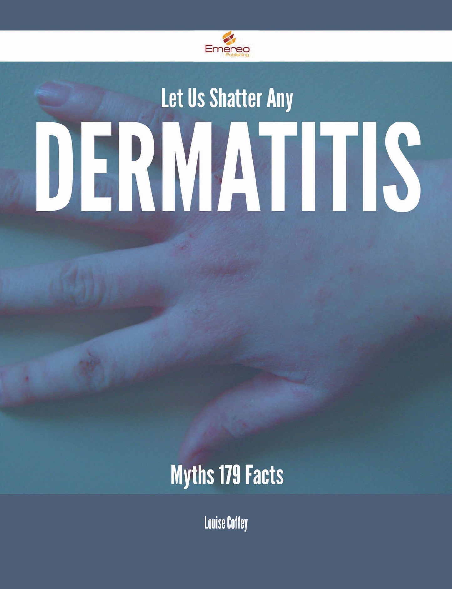Let Us Shatter Any Dermatitis Myths - 179 Facts