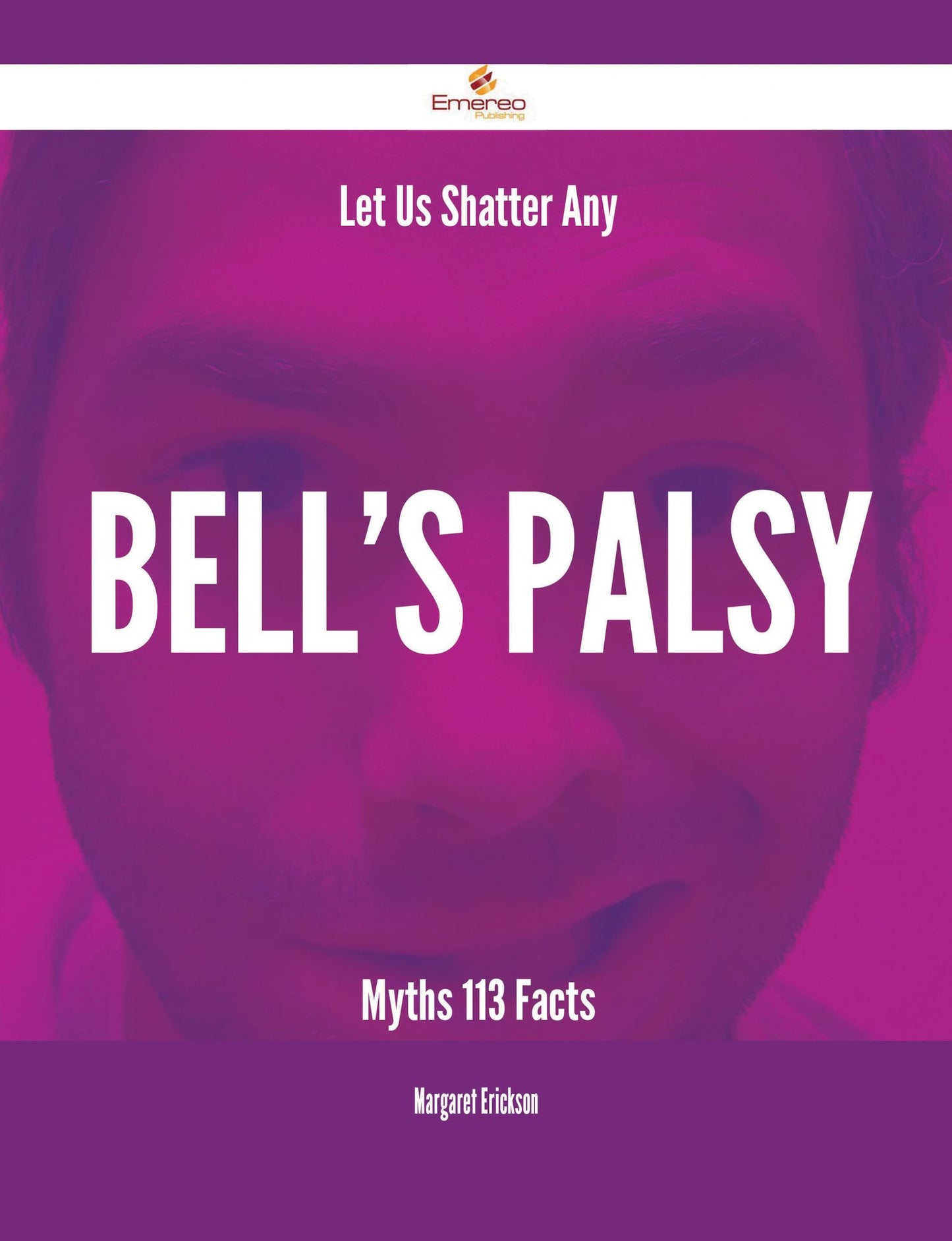 Let Us Shatter Any Bell's palsy Myths - 113 Facts