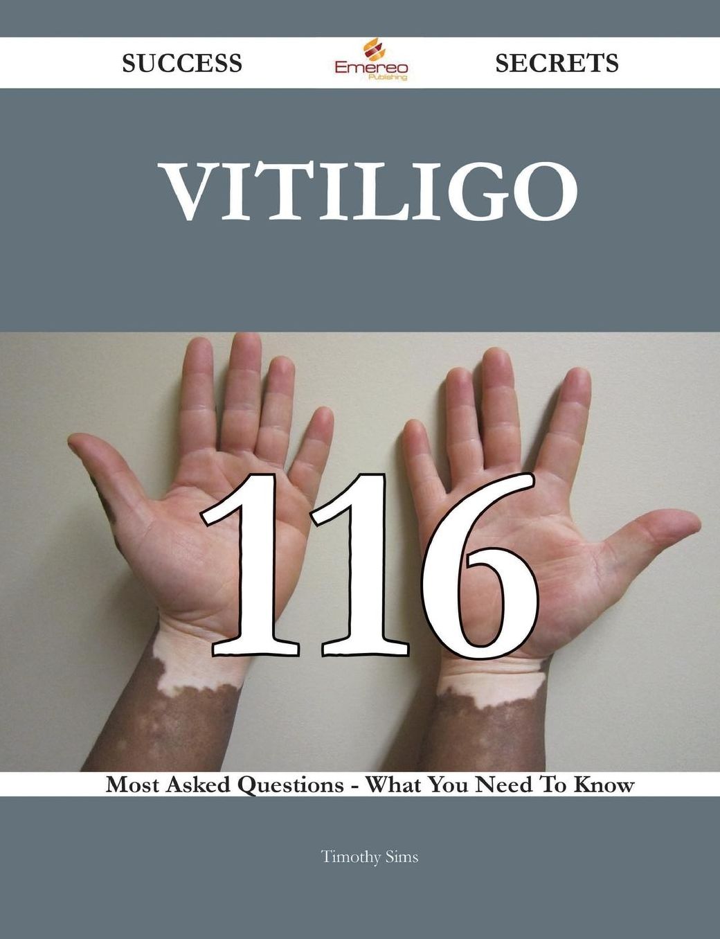 Vitiligo 116 Success Secrets - 116 Most Asked Questions On Vitiligo - What You Need To Know
