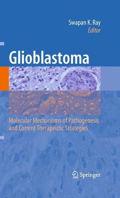 Glioblastoma: Molecular Mechanisms of Pathogenesis and Current Therapeutic Strategies