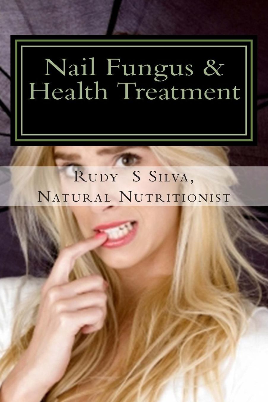 Nail Fungus & Health Treatment: Fix Your Fingernail?s Health And Look Beautiful