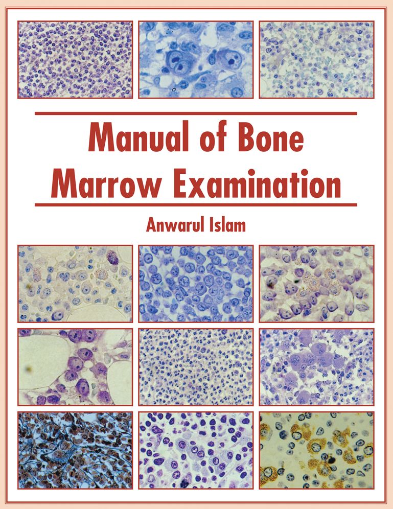 Manual of Bone Marrow Examination