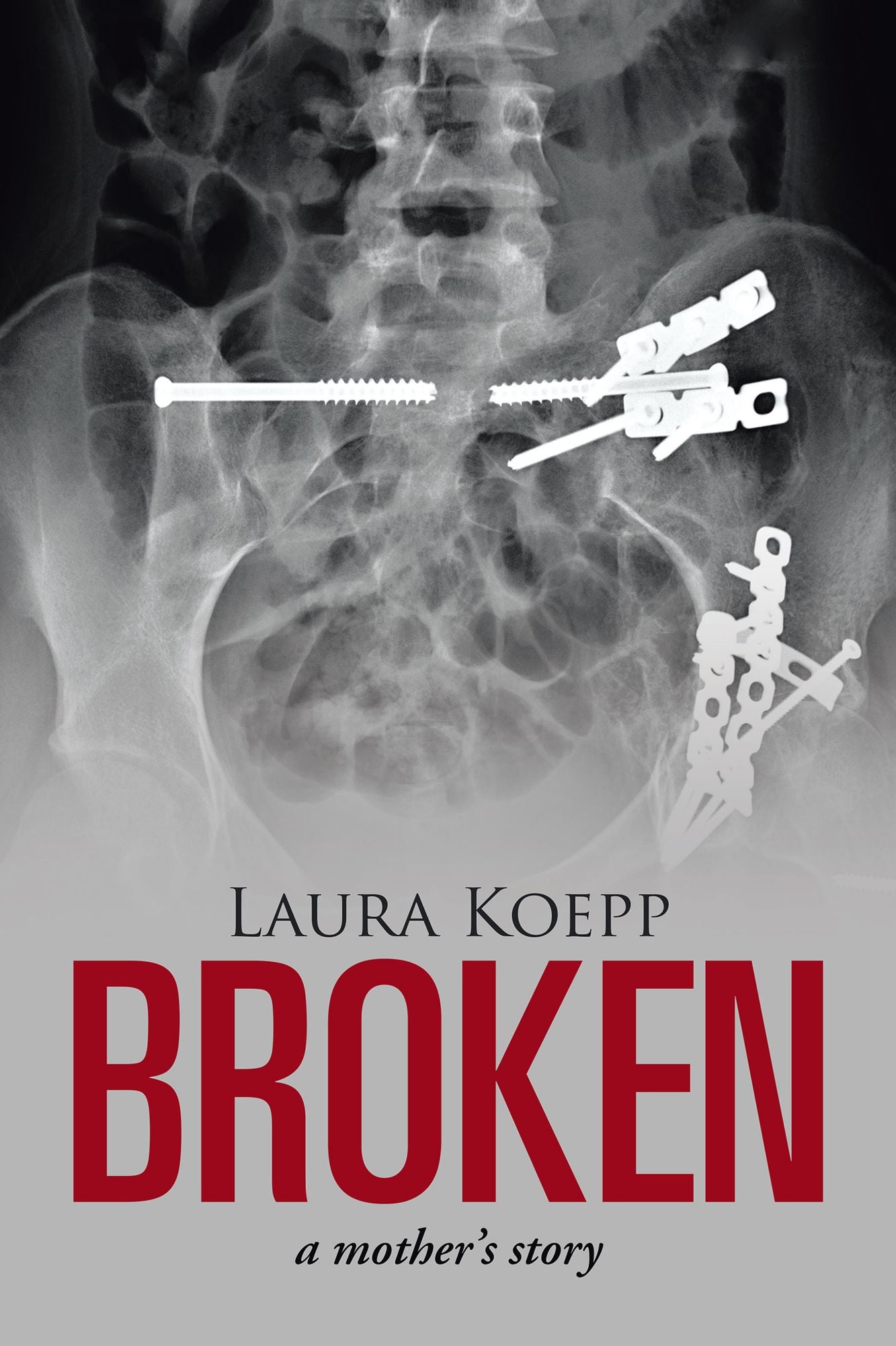 Broken: a mother's story