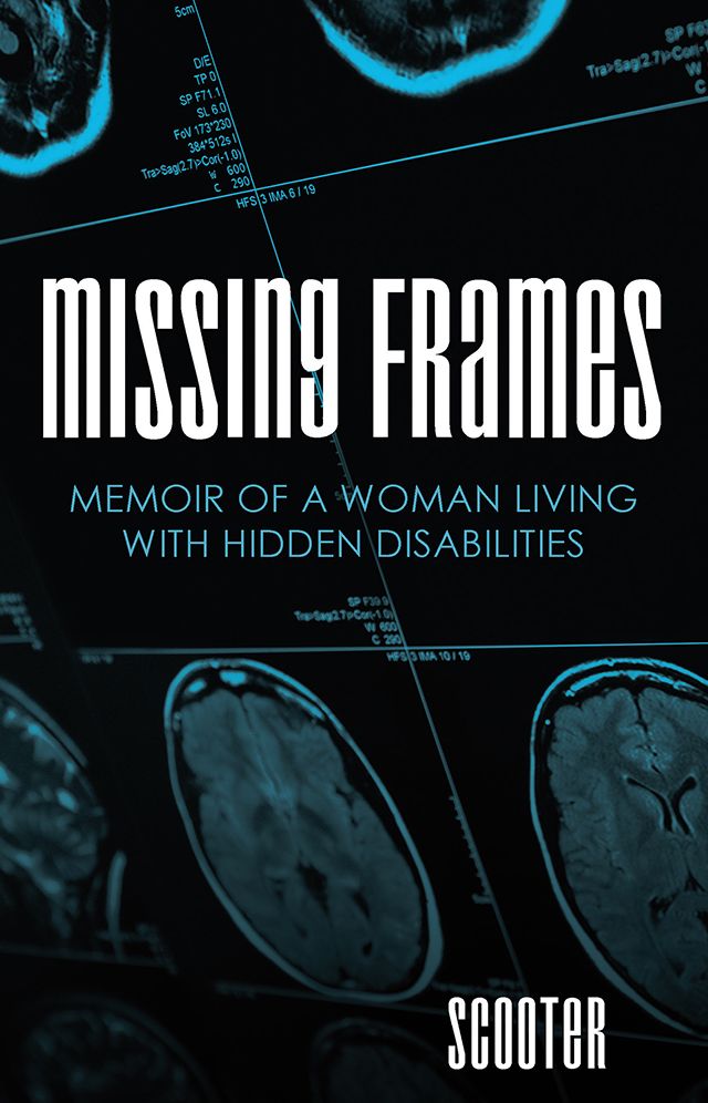 Missing Frames: Memoir of a Woman Living with Hidden Disabilities