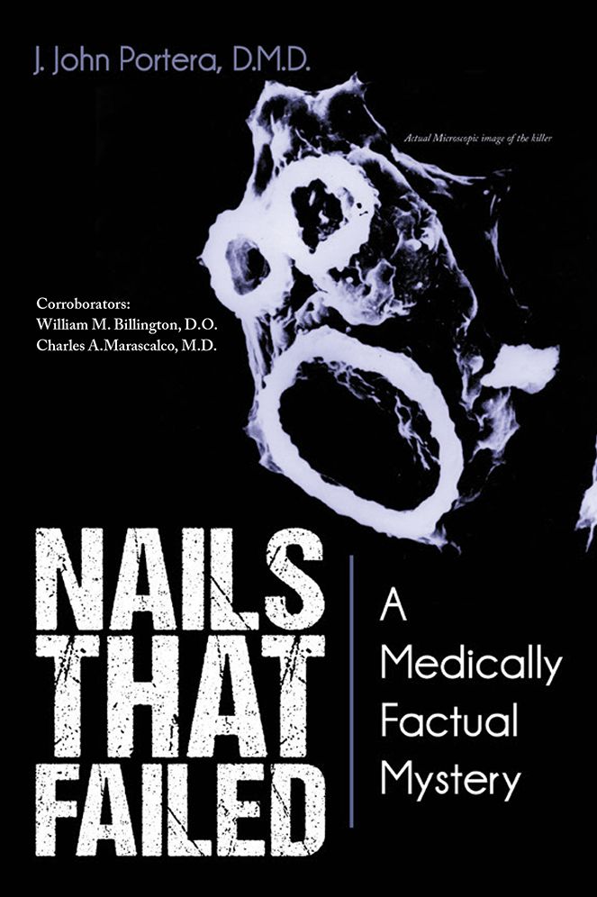 Nails That Failed: A Medically Factual Mystery