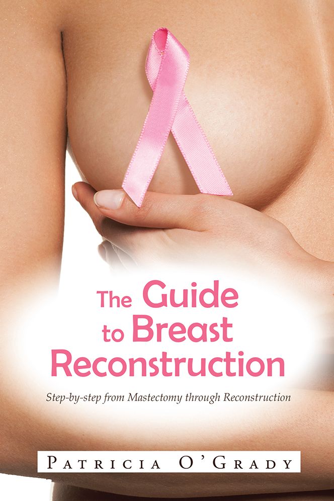 The Guide to Breast Reconstruction: Step-by-step from Mastectomy through Reconstruction