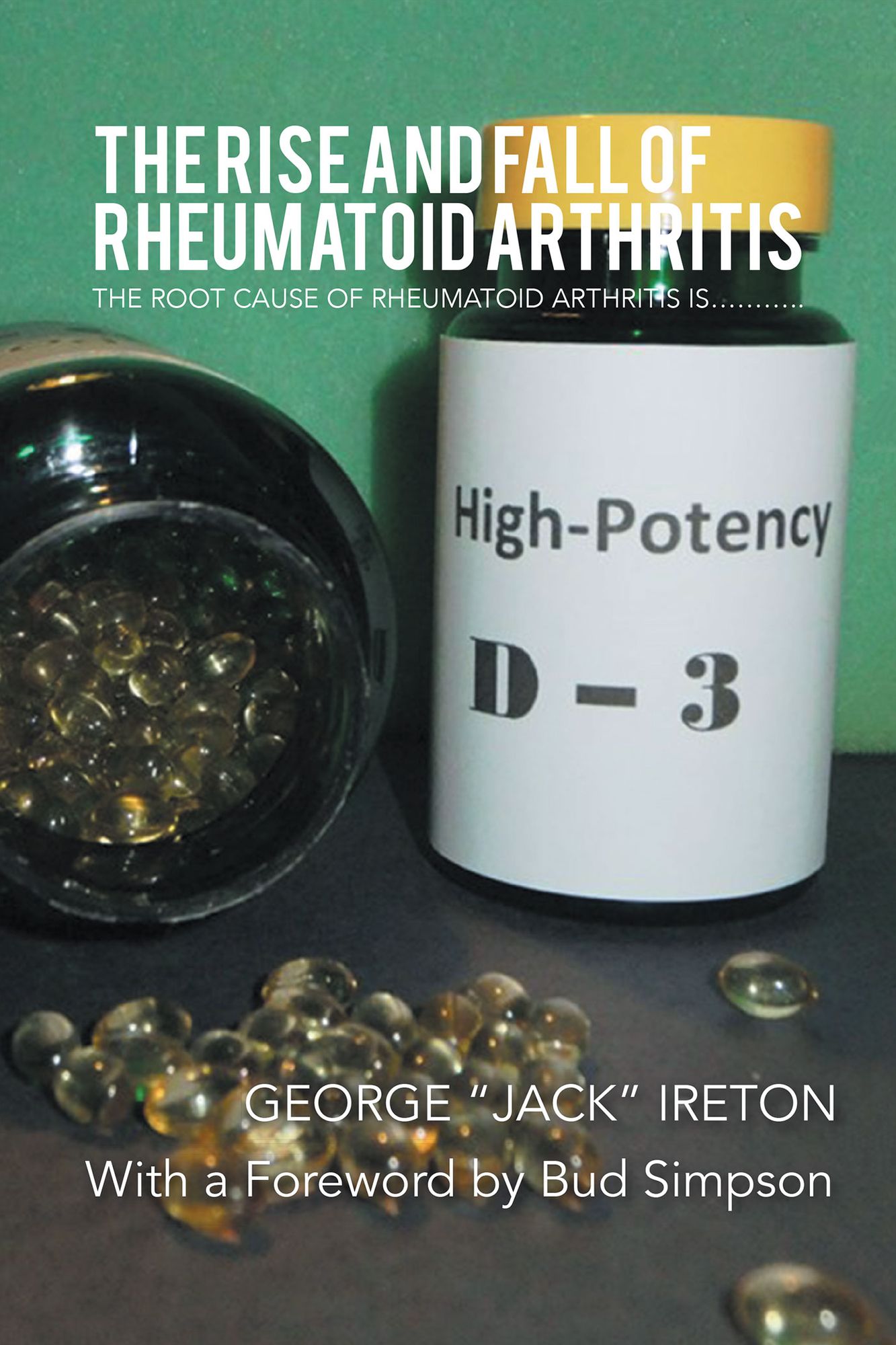 THE RISE AND FALL OF RHEUMATOID ARTHRITIS: THE ROOT CAUSE OF RHEUMATOID ARTHRITIS IS...........
