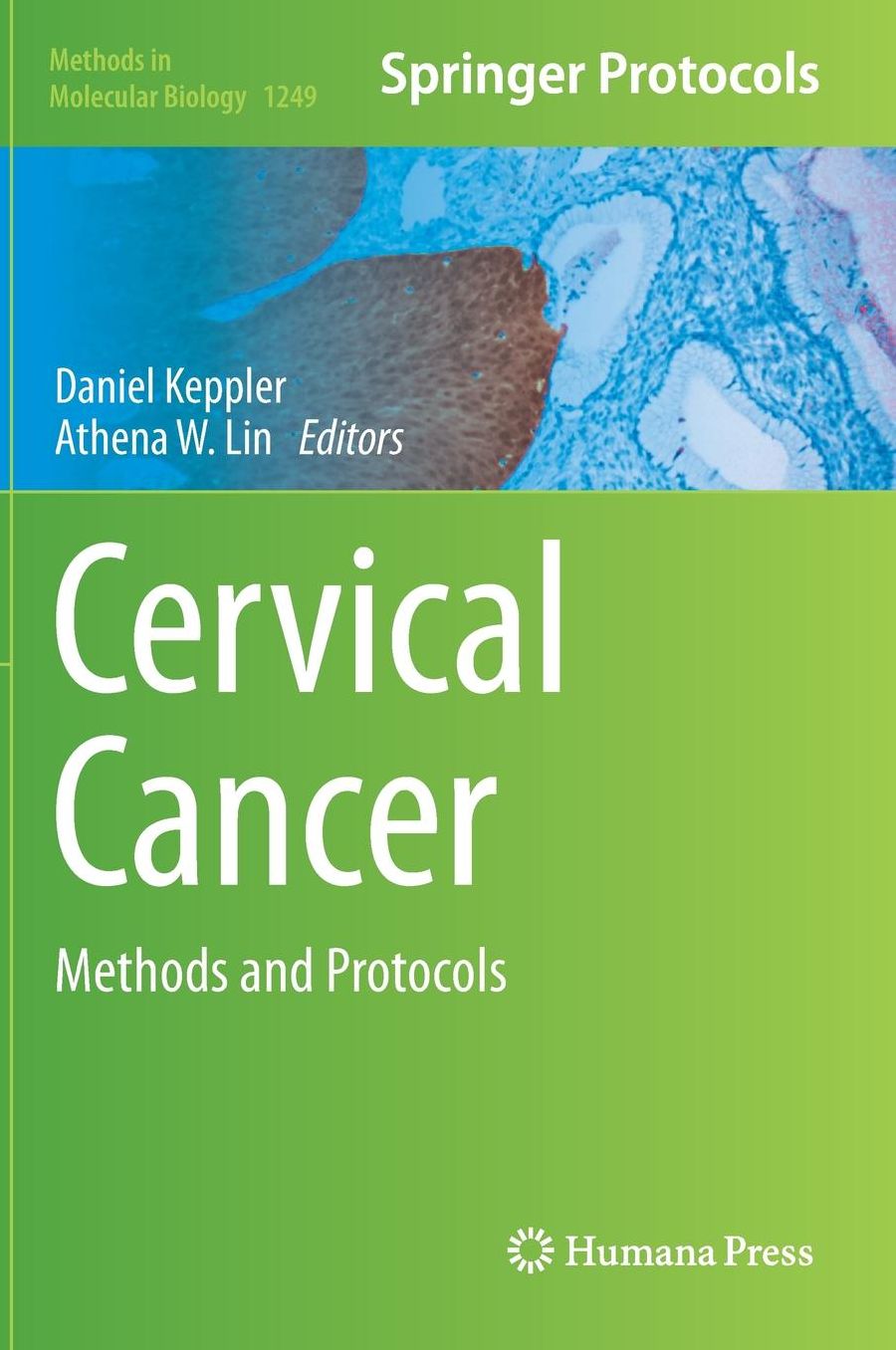 Cervical Cancer: Methods and Protocols