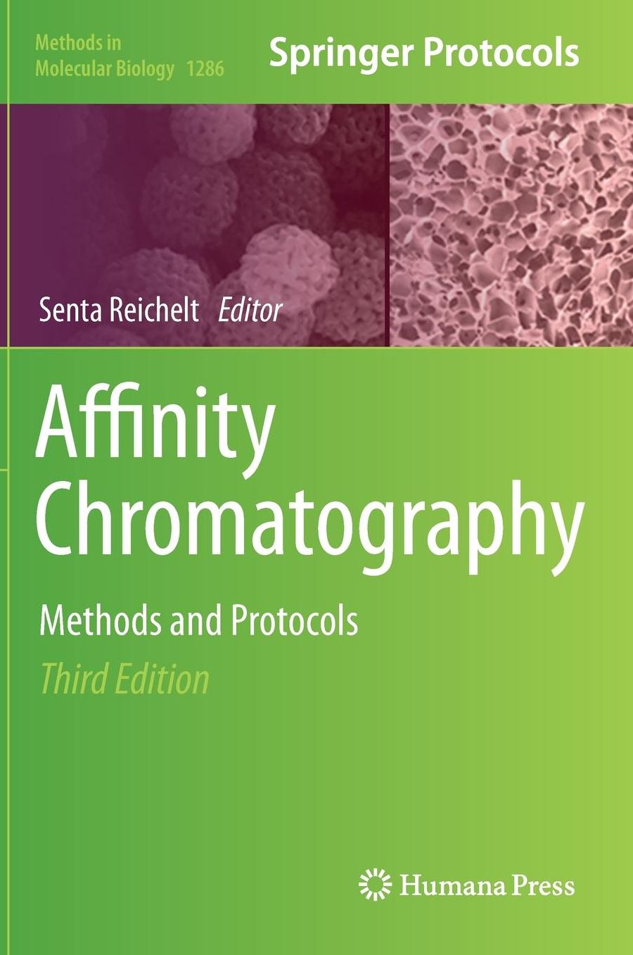 Affinity Chromatography: Methods and Protocols