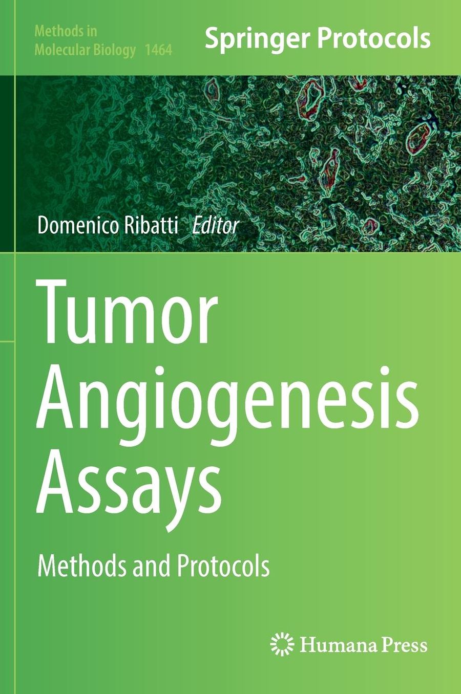 Tumor Angiogenesis Assays: Methods and Protocols