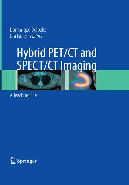 Hybrid PET/CT and SPECT/CT Imaging: A Teaching File