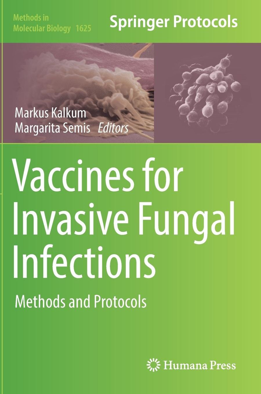 Vaccines for Invasive Fungal Infections: Methods and Protocols