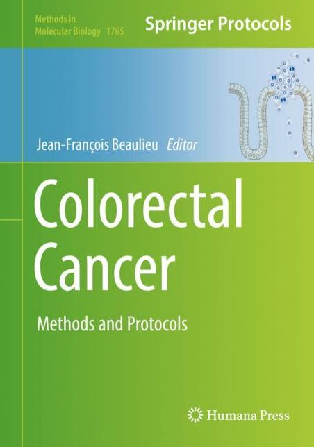 Colorectal Cancer: Methods and Protocols