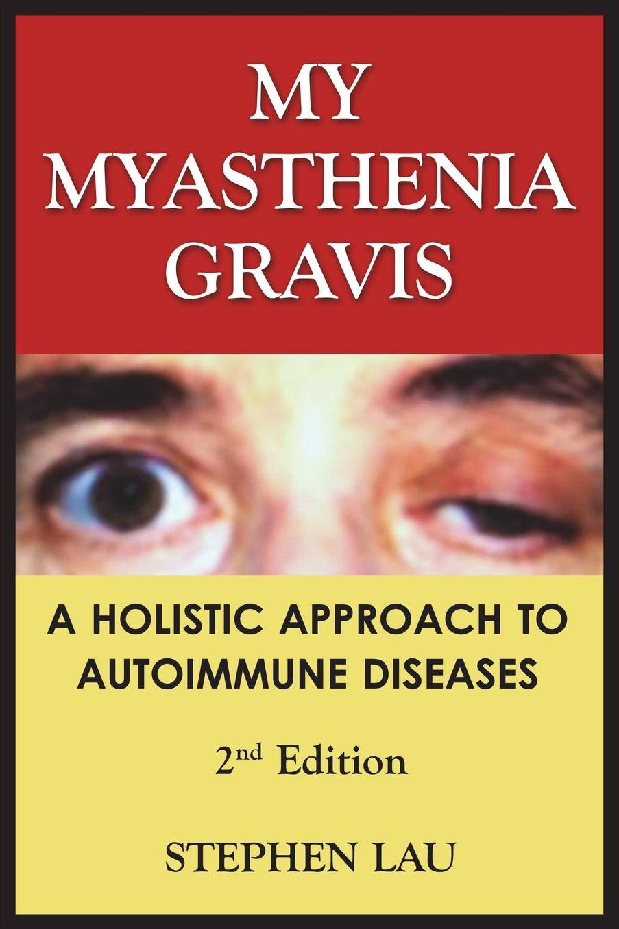 My Myasthenia Gravis: A Holistic Approach to Autoimmune Diseases