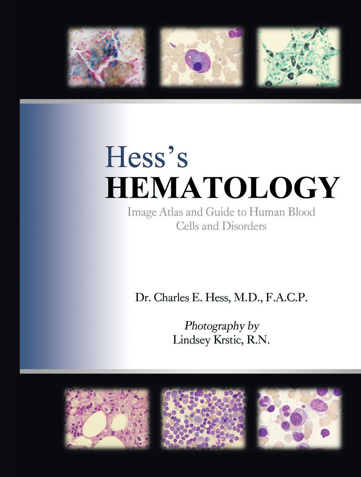 Hess' Hematology: Image Atlas and Guide to Human Blood Cells and Disorders