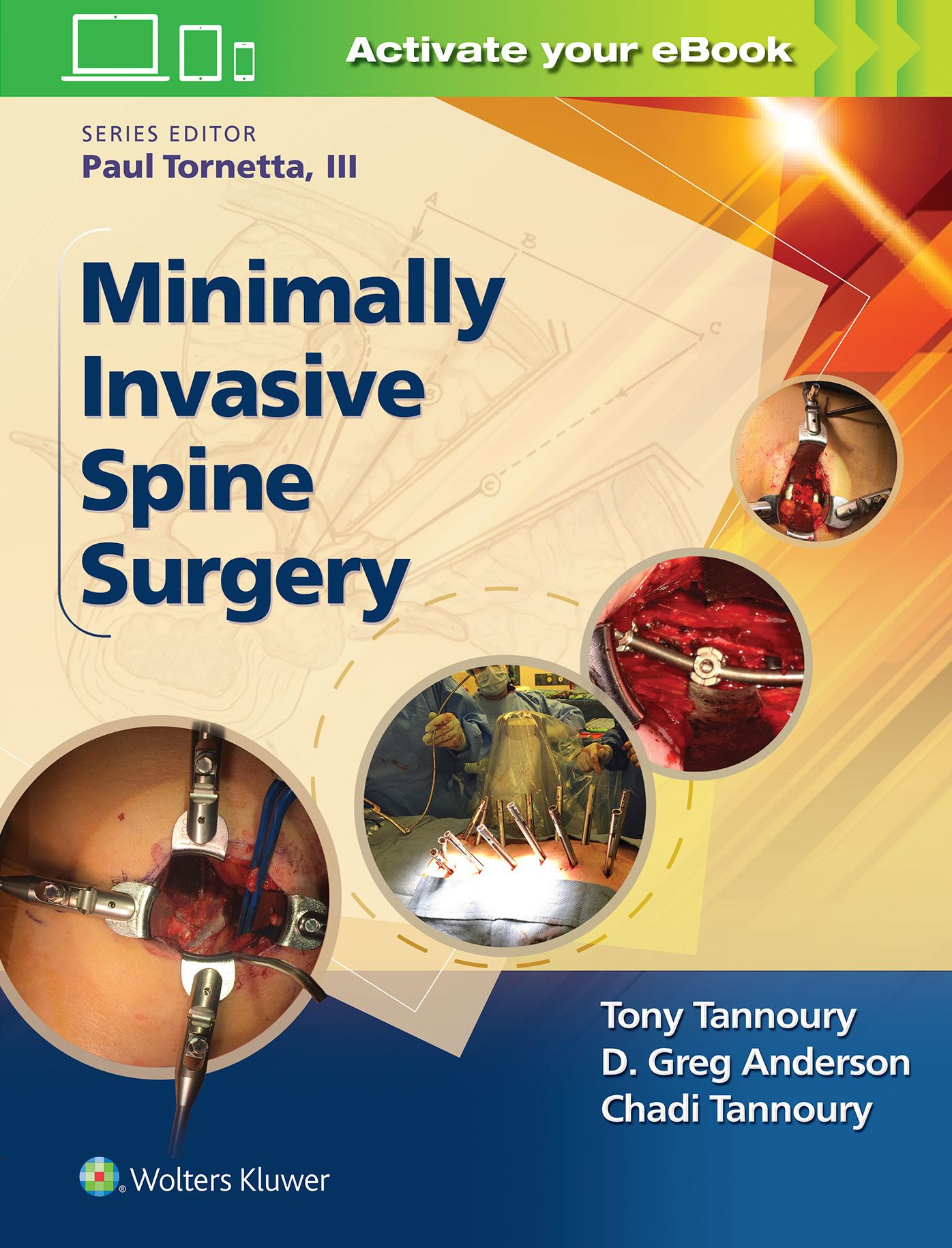 Minimally Invasive Spine Surgery
