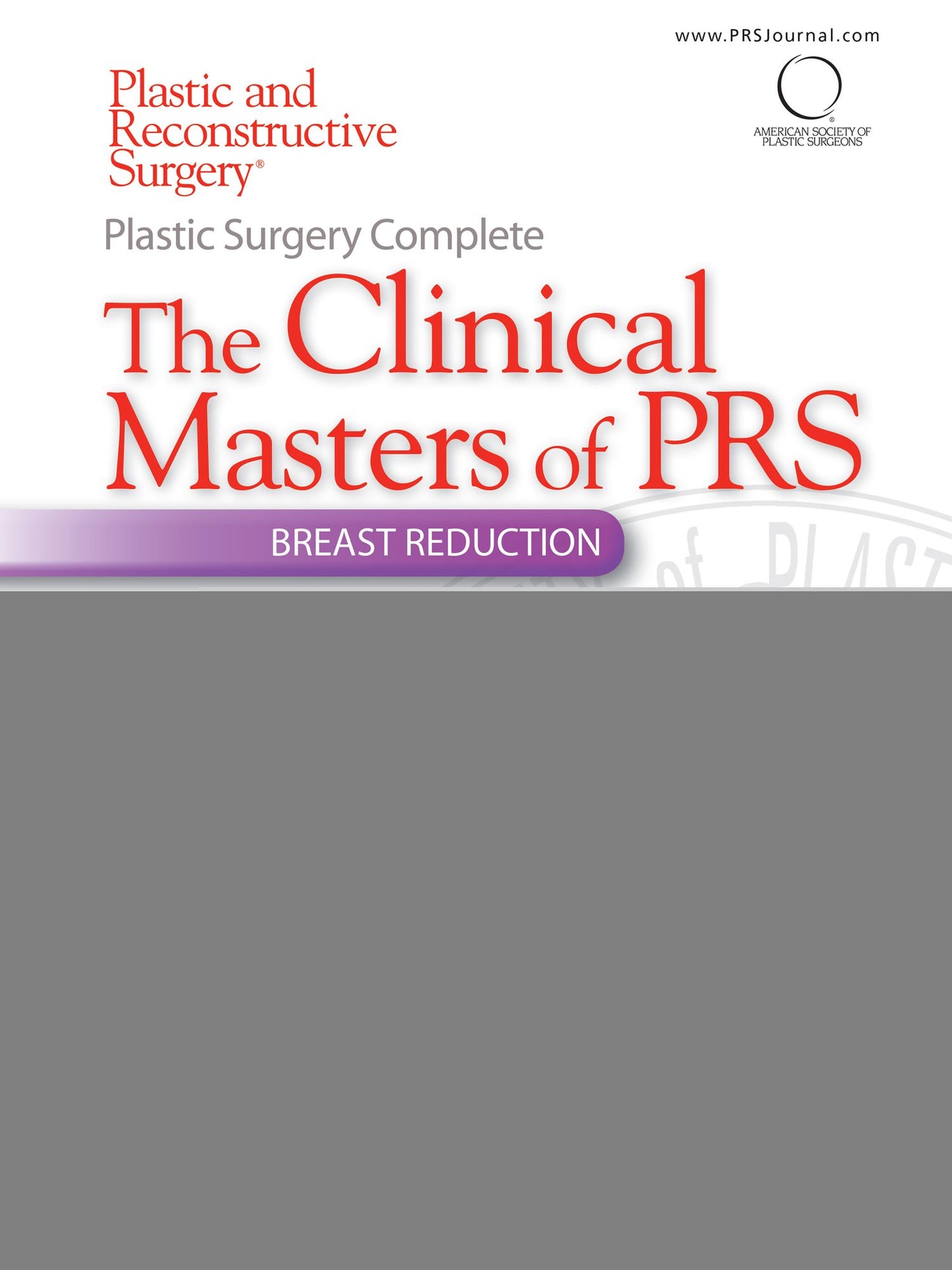 Plastic Surgery Complete: The Clinical Masters of PRS: Breast Reduction