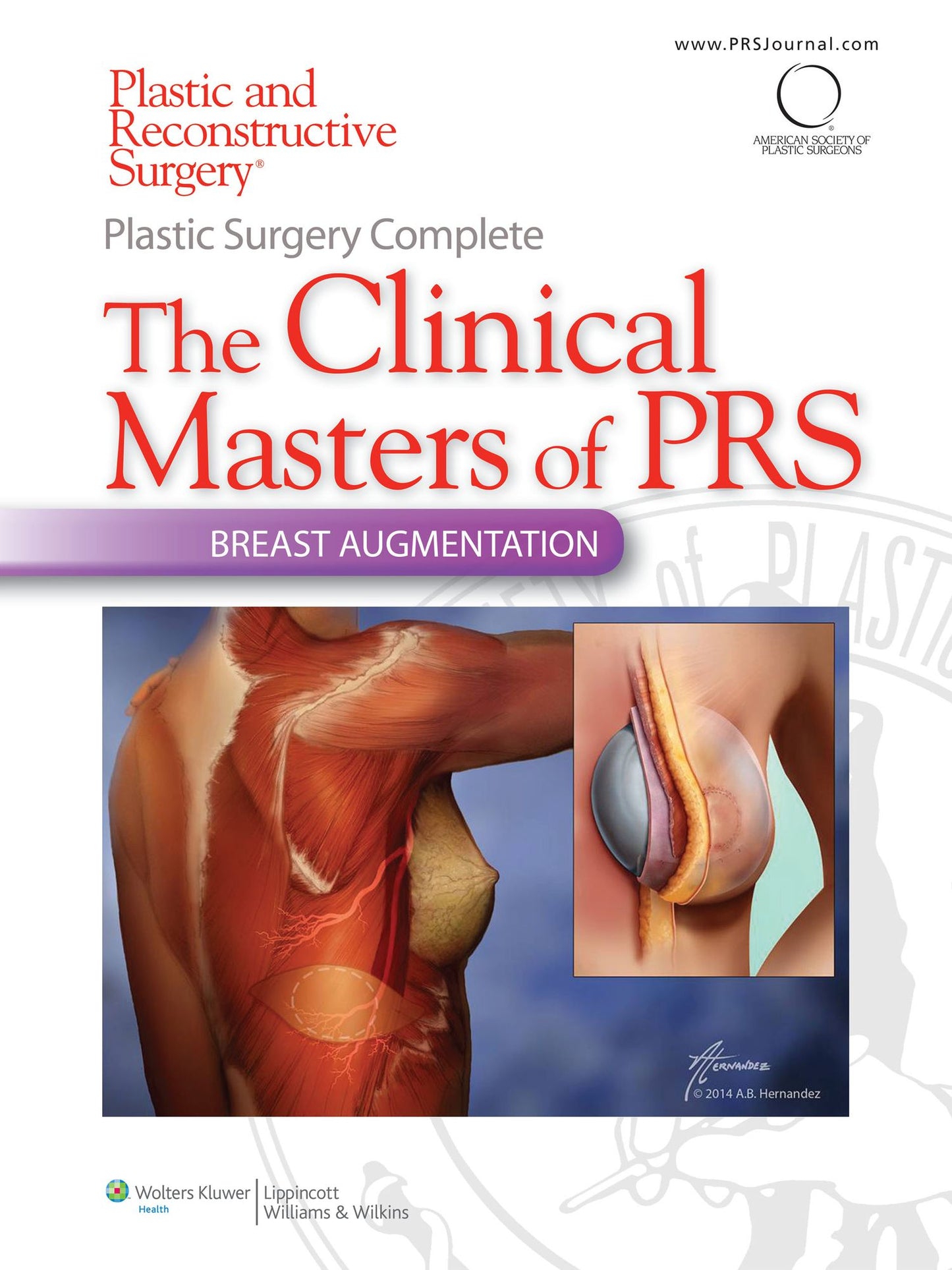 Plastic Surgery Complete: The Clinical Masters of PRS- Breast Augmentation