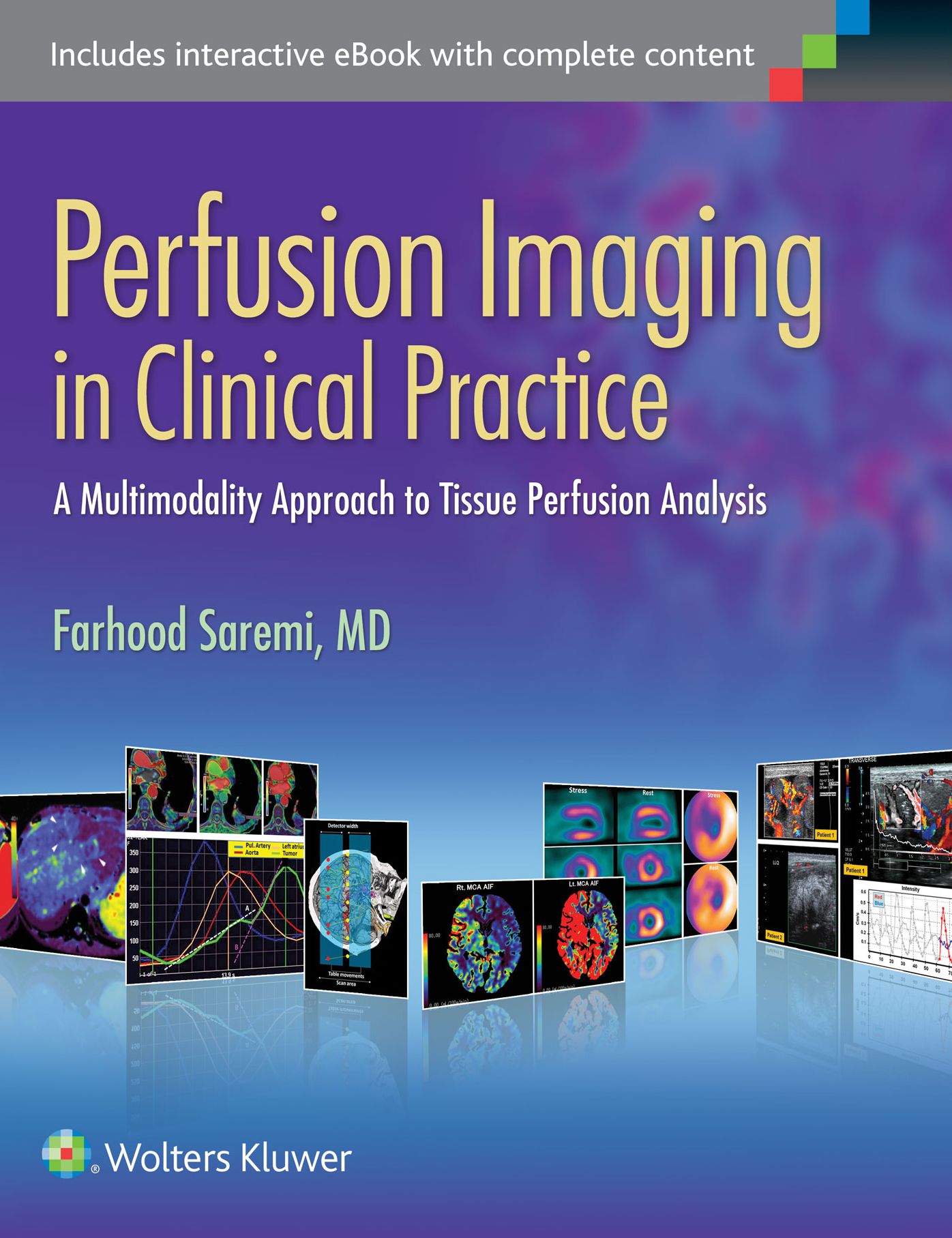 Perfusion Imaging in Clinical Practice: A Multimodality Approach to Tissue Perfusion Analysis