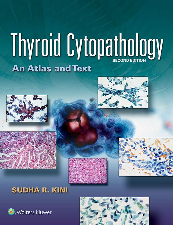 Thyroid Cytopathology: An Atlas and Text