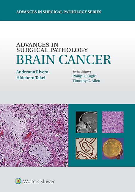 Advances in Surgical Pathology: Brain Cancer