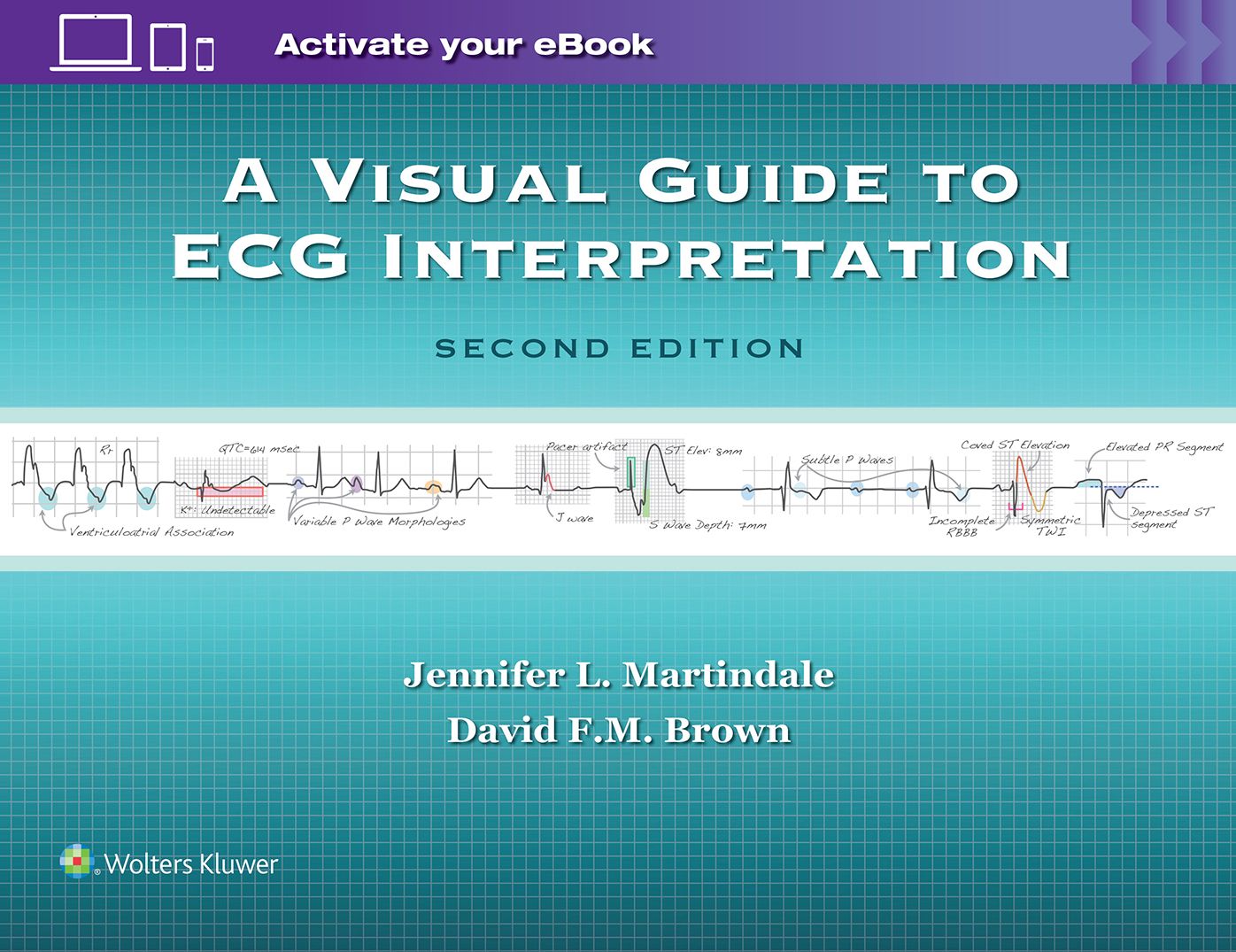 A Visual Guide to ECG Interpretation