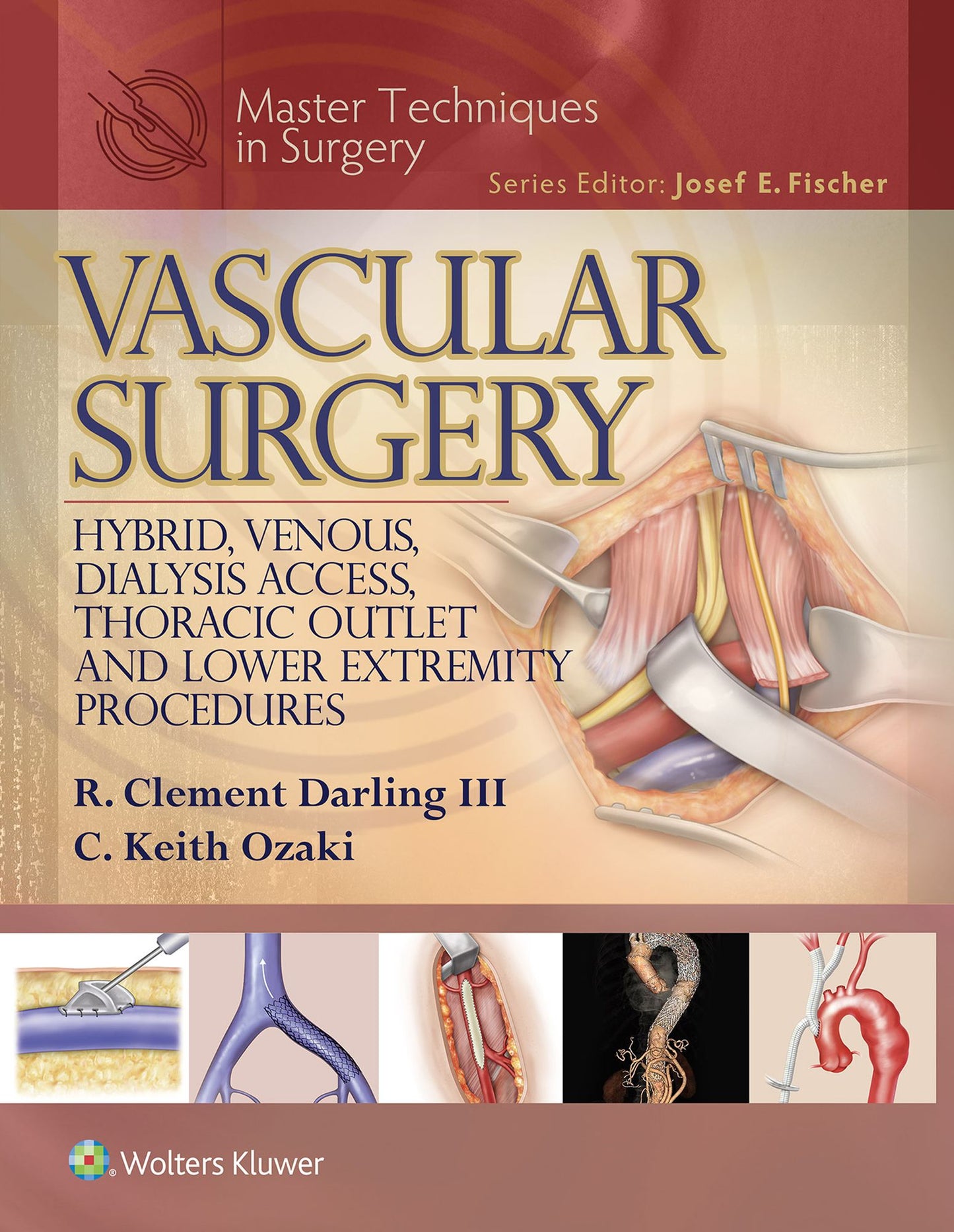 Master Techniques in Surgery: Vascular Surgery: Hybrid, Venous, Dialysis Access, Thoracic Outlet, and Lower Extremity Procedures