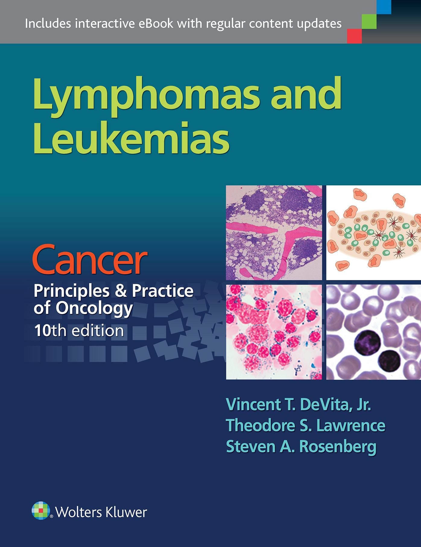 Lymphomas and Leukemias: Cancer: Principles & Practice of Oncology, 10th Edition