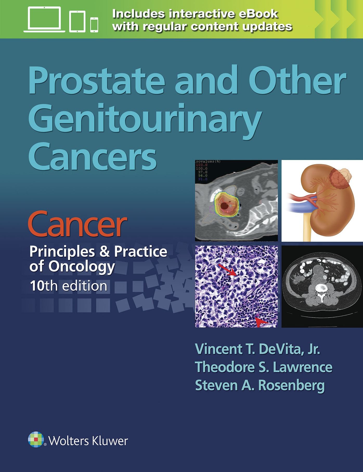 Prostate and Other Genitourinary Cancers: From Cancer: Principles & Practice of Oncology