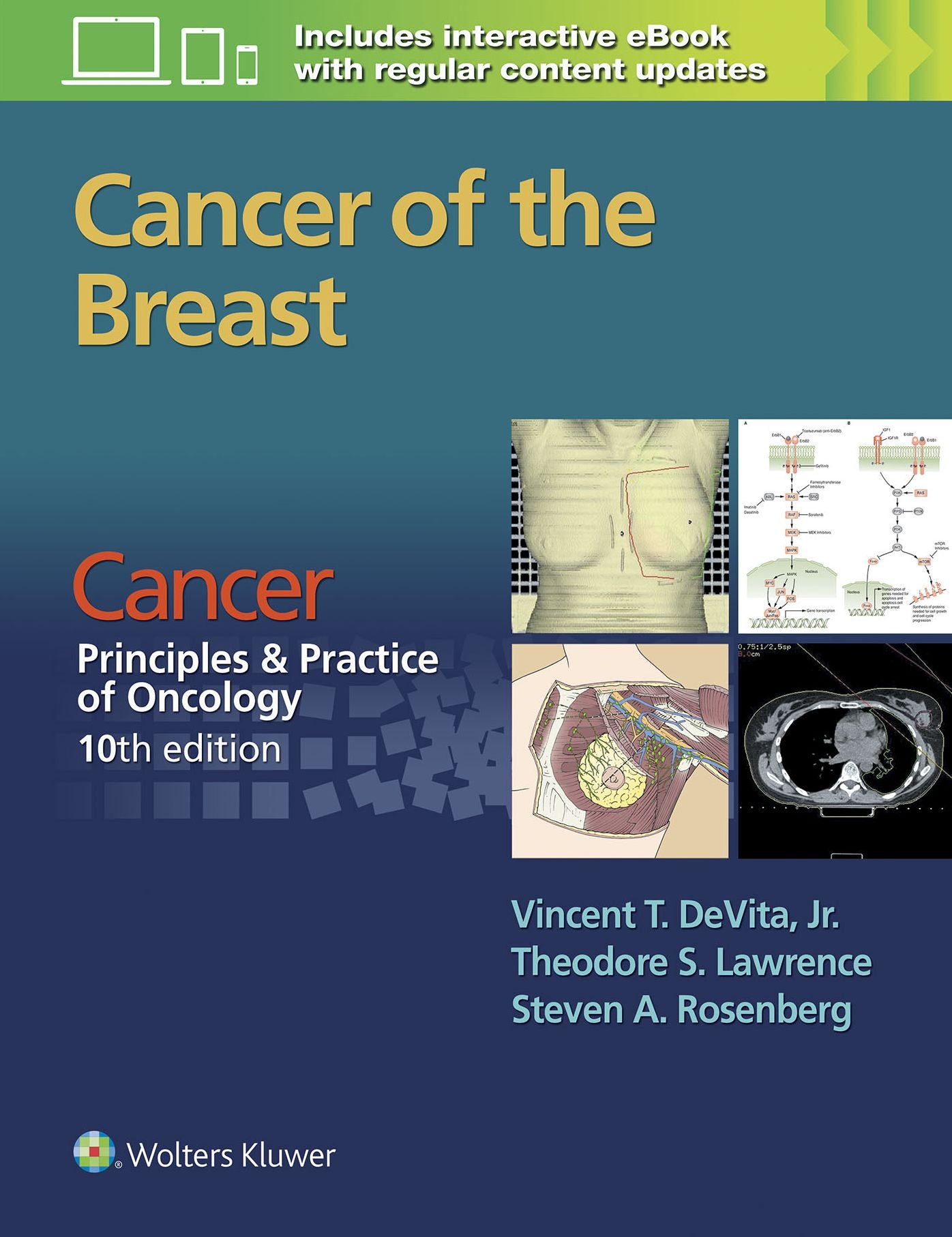 Cancer of the Breast: From Cancer: Principles & Practice of Oncology, 10th edition
