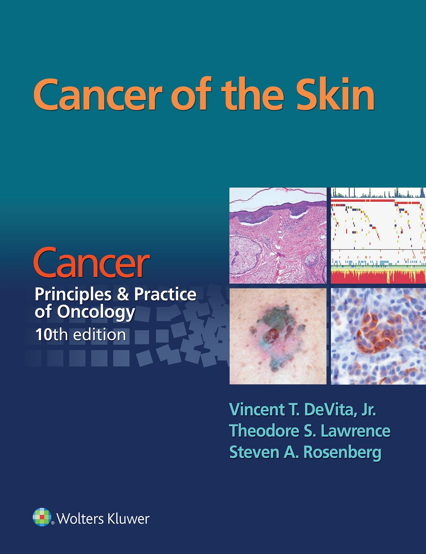 Cancer of the Skin: Cancer: Principles & Practice of Oncology, 10th edition