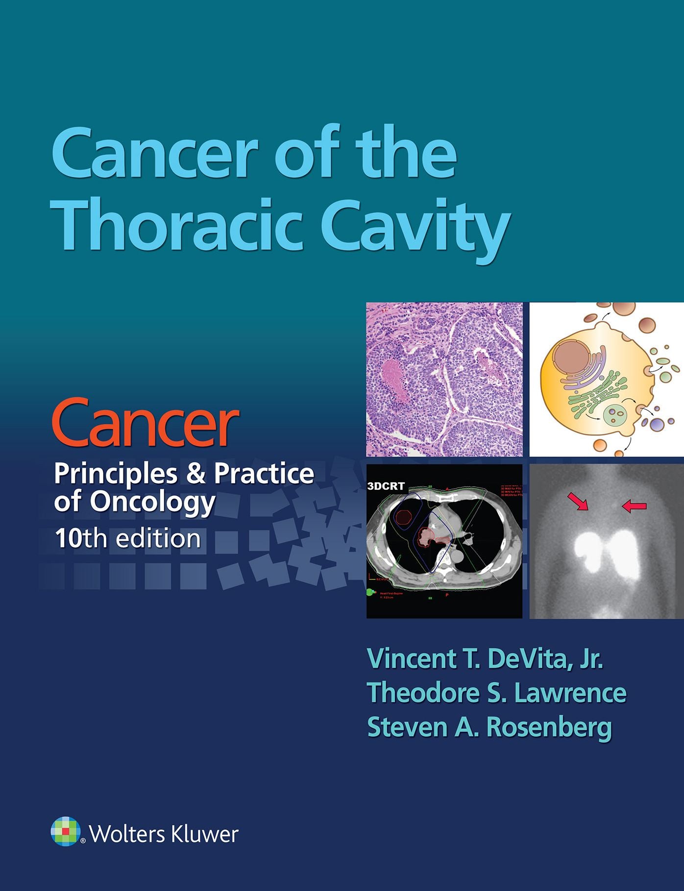 Cancer of the Thoracic Cavity: Cancer: Principles & Practice of Oncology, 10th edition