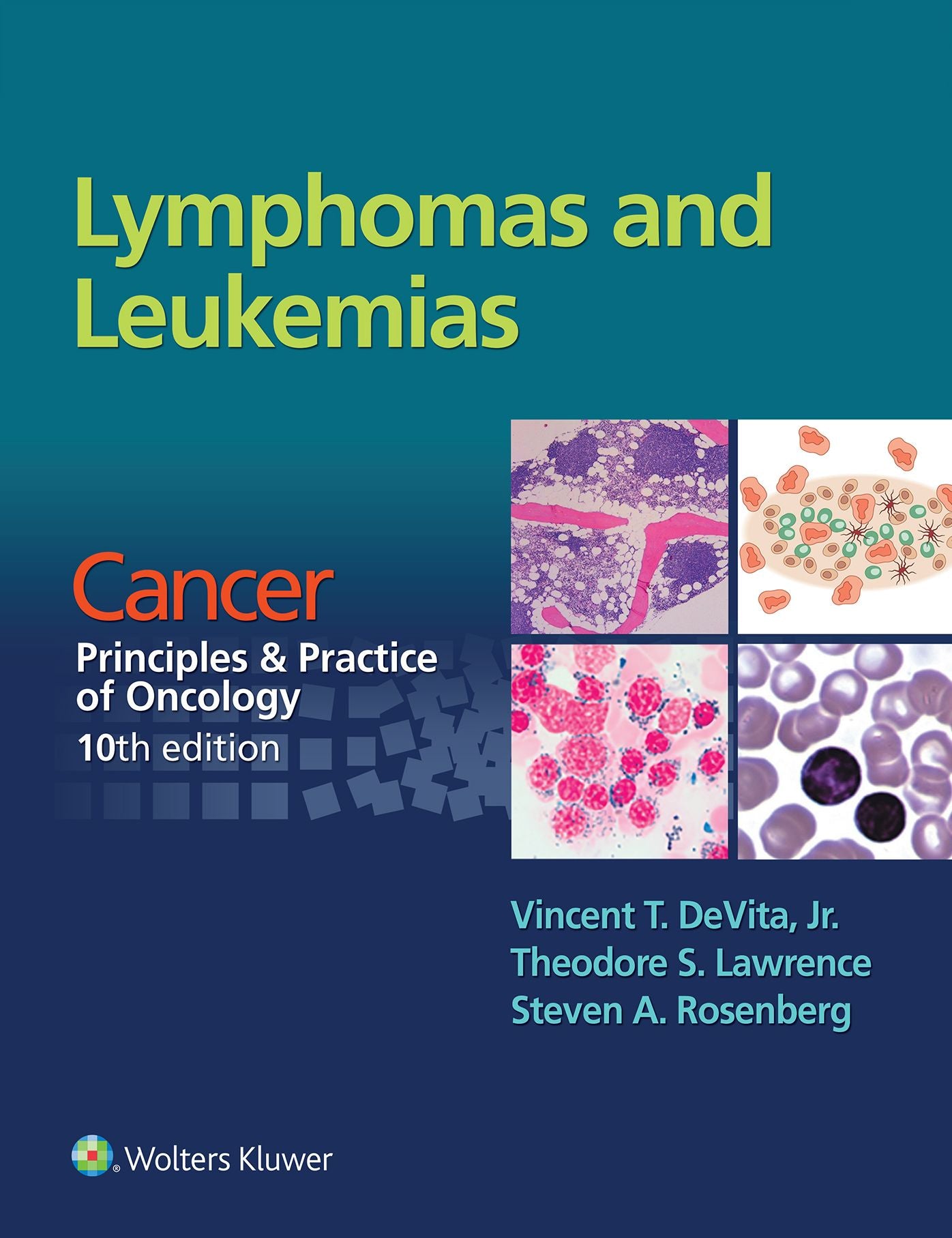 Lymphomas and Leukemias: Cancer: Principles & Practice of Oncology, 10th edition