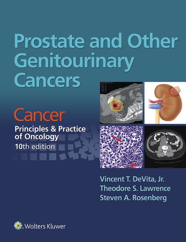 Prostate and Other Genitourinary Cancers: From Cancer: Principles & Practice of Oncology, 10th edition