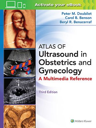 Atlas of Ultrasound in Obstetrics and Gynecology