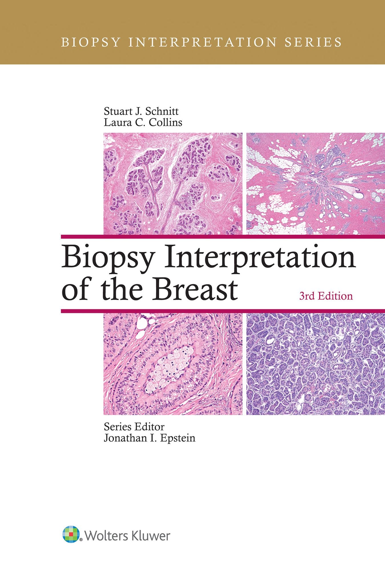 Biopsy Interpretation of the Breast