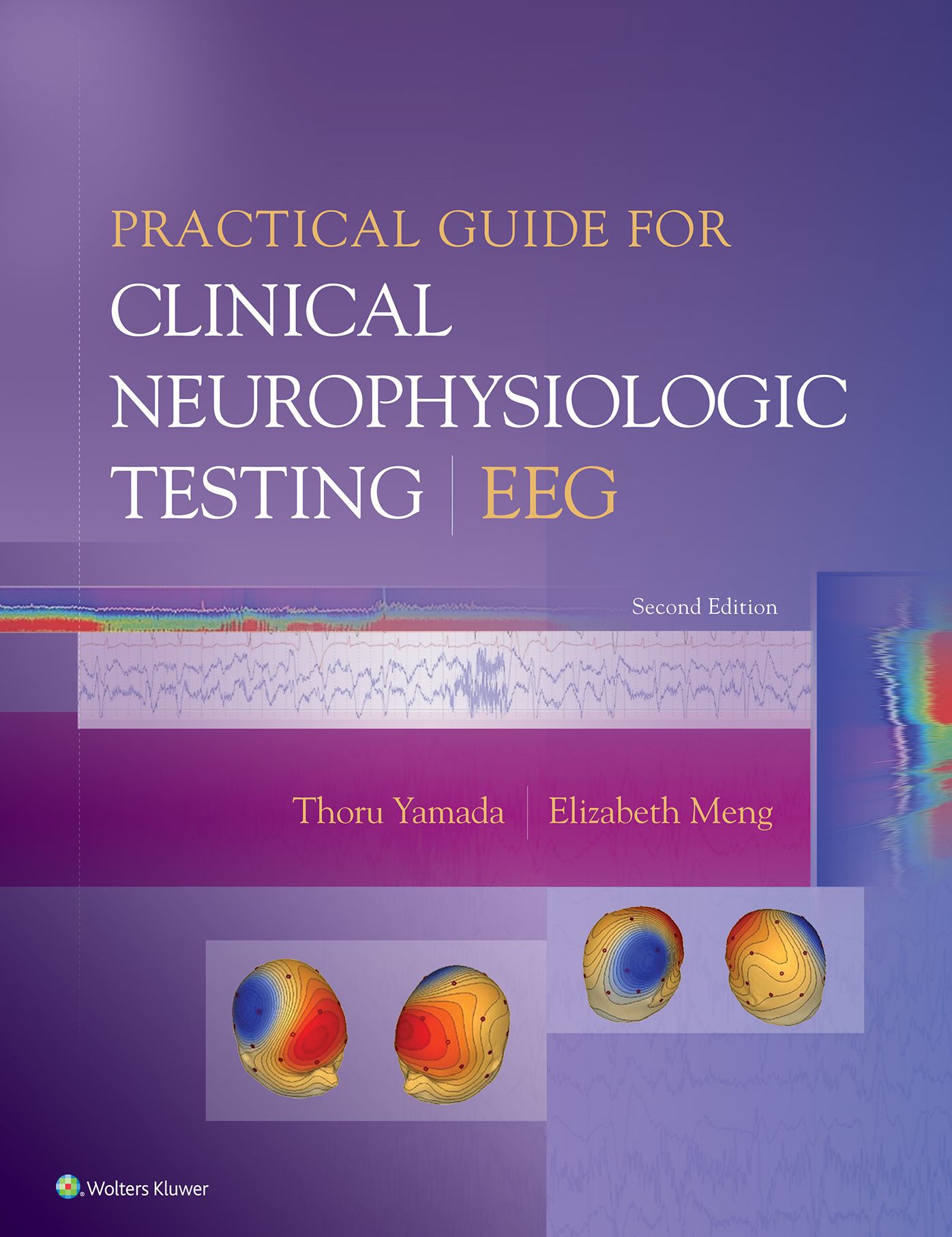 Practical Guide for Clinical Neurophysiologic Testing: EEG