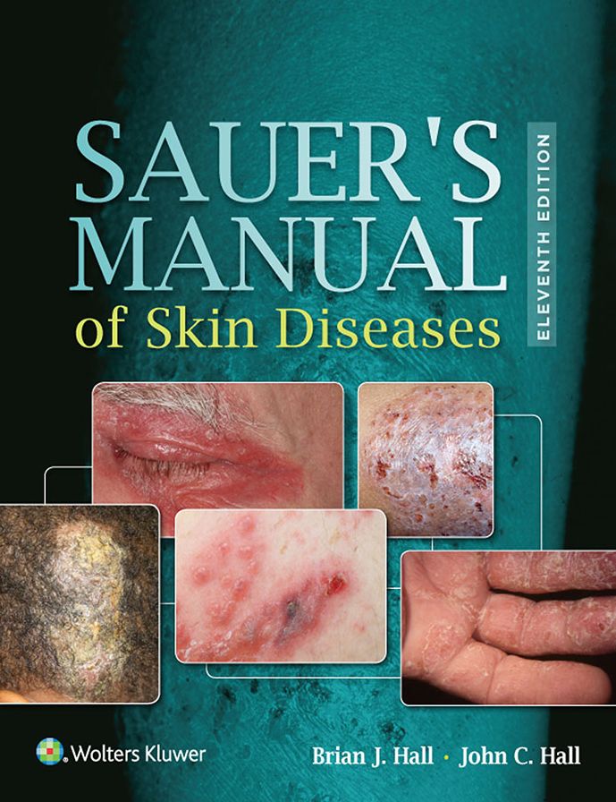 Sauer's Manual of Skin Diseases