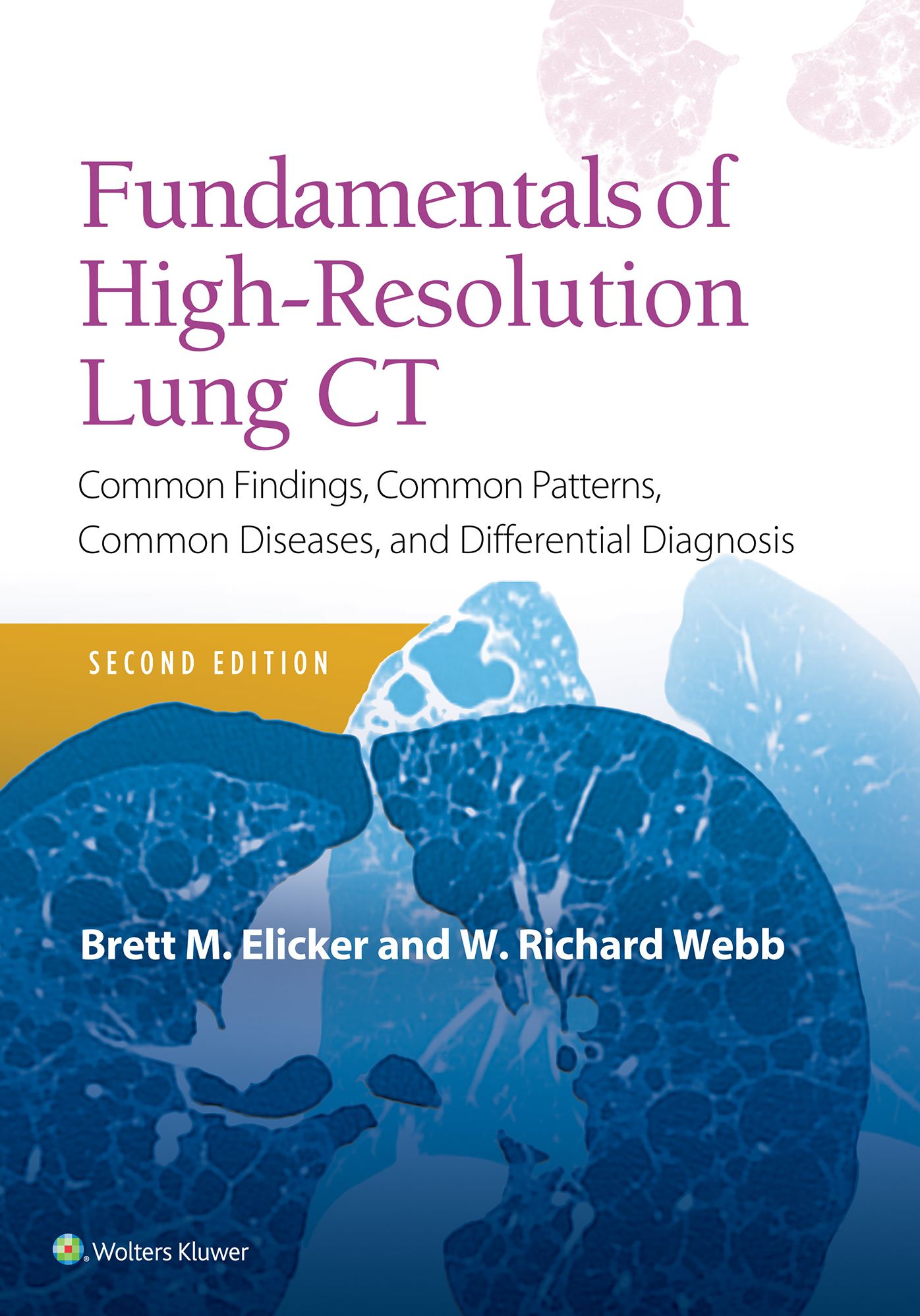 Fundamentals of High-Resolution Lung CT: Common Findings, Common Patterns, Common Diseases and Differential Diagnosis
