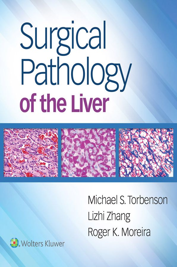 Surgical Pathology of the Liver